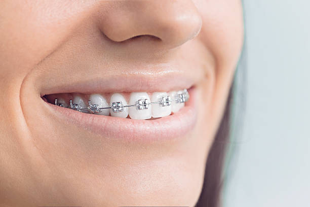 Best Dental Inlays and Onlays  in Overland, MO